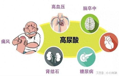 痛风可以吃凉瓜么,痛风患者可适量食用凉瓜